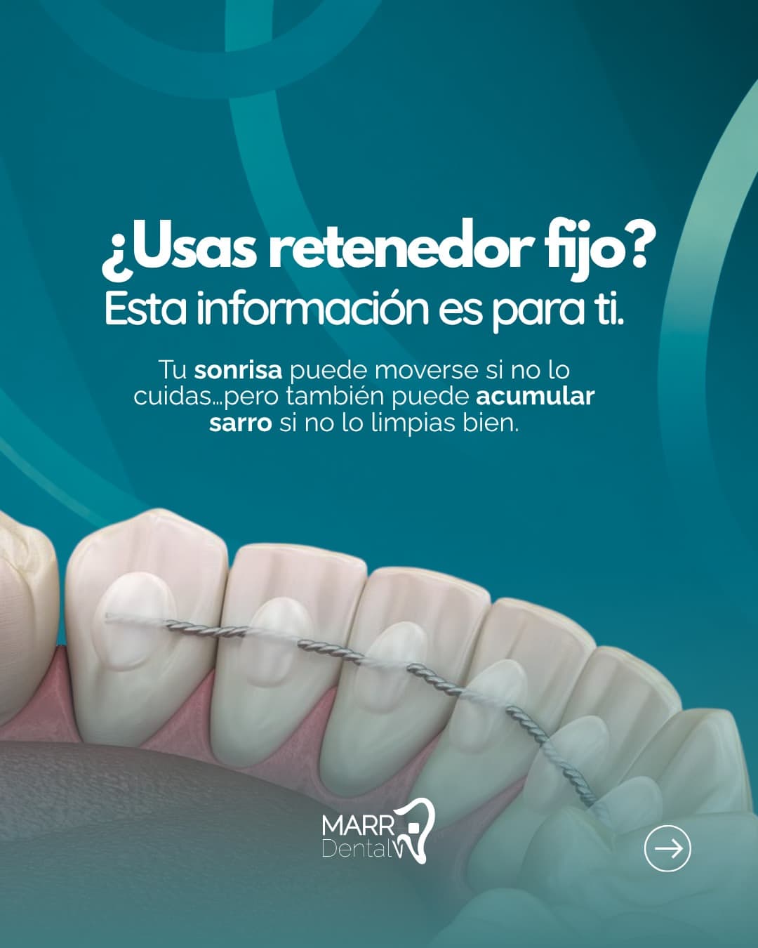 Trabajo Doya 31